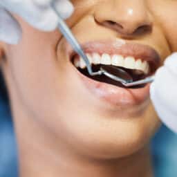 Close up of dental examination